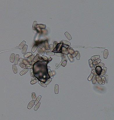 Spores of this fungal pathogen survive winter on infected plant
