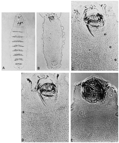 714 J. Noordermeer and others Fig. 2. Comparison of cuticle phenotype of heatshocked rosy 506 (A), heatshocked HS-wg (B, C and D) and naked7e89 (E) larvae. Anterior is up.