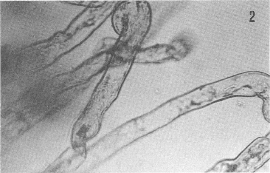 678 SHANTHARAM AND WONG APPL. ENVIRON. MICROBIOL. p 41' N2 FIG. 1 to 3. Light micrographs of lima bean root hairs as affected by inoculation with Rhizobium sp. 127E15. (Fig. 1) Uninoculated root hair.