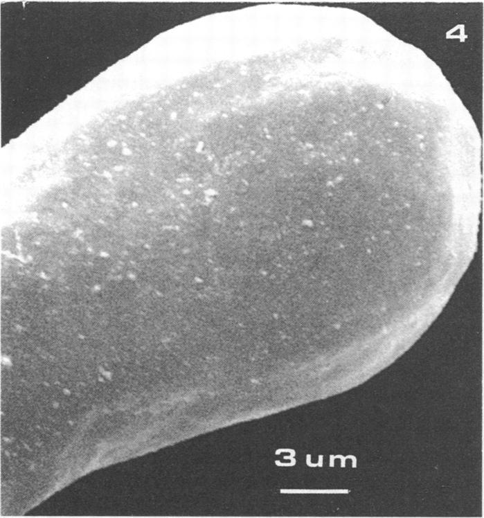 VOL. 43, 1982 HOST RECOGNITION BY RHIZOBIUM 679 FIG. 4 to 8. Scanning electron micrographs of lima bean root hairs as affected by inoculation with Rhizobium sp. 127E15. (Fig.