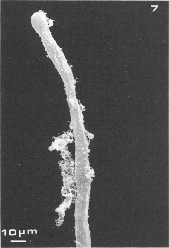 Curling and swelling were seen in 8 out of 10 young and short (150 to 250,um) root hairs counted randomly. Within 2 days, infection threads were observed (Fig. 3).