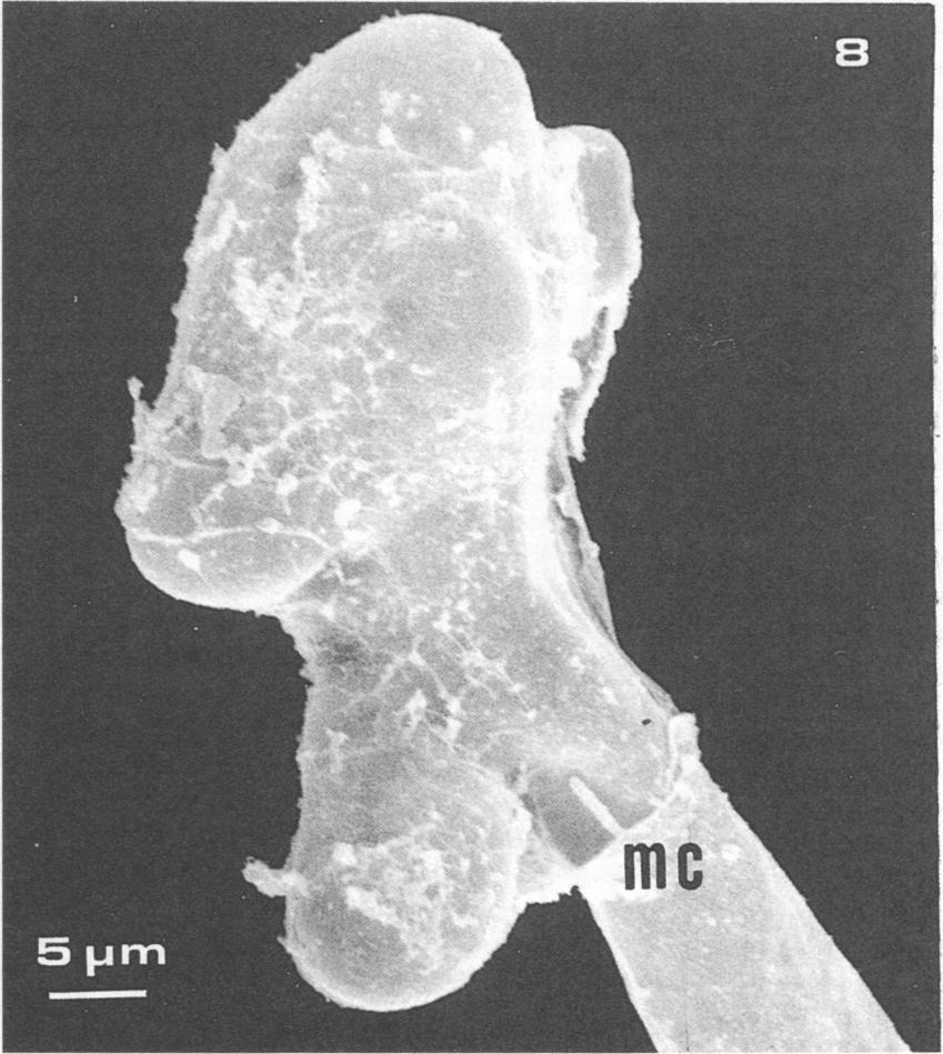 127E15 on lima bean root hair was clearly visualized by scanning electron micrographs (Fig. 5 through 8). The uninoculated control root hair was relatively clean and smooth (Fig. 4).