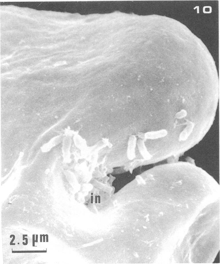 The pole bean interacted specifically with R. phaseoli 127K14, as shown in Fig. 11 through APPL. ENVIRON. MICROBIOL. 14. Uninoculated root hairs were straight and not deformed (Fig. 11).