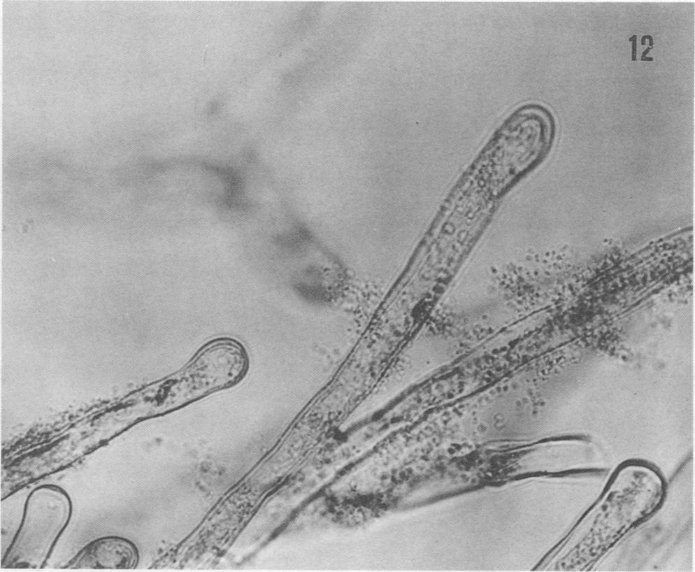 Light micrographs of pole bean root hairs as affected by inoculation with R.