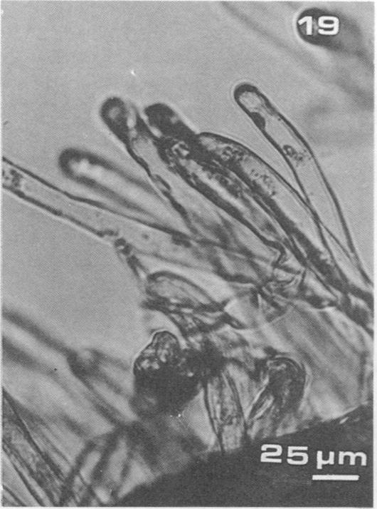 VOL. 43, 1982 HOST RECOGNITION BY RHIZOBIUM 683 FIG. 19 to 22. Light micrographs of pole bean root hairs as affected by inoculation with Rhizobium sp. 127E15. (Fig.