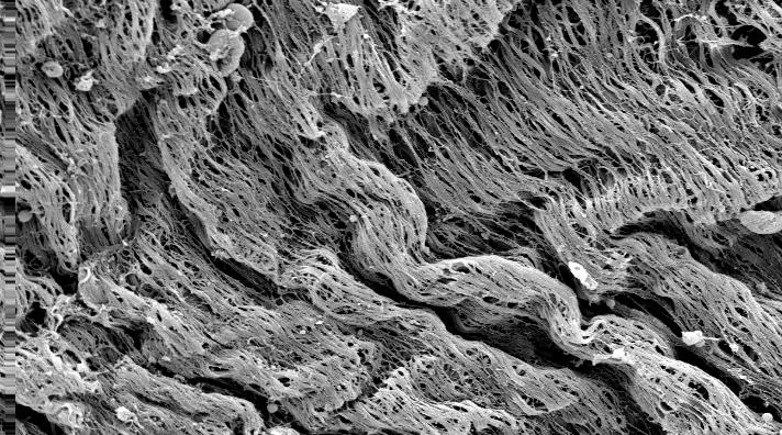 64 detachment of endothelial cells, leaving large areas of exposed subendothelial tissue (Fig. 3C).