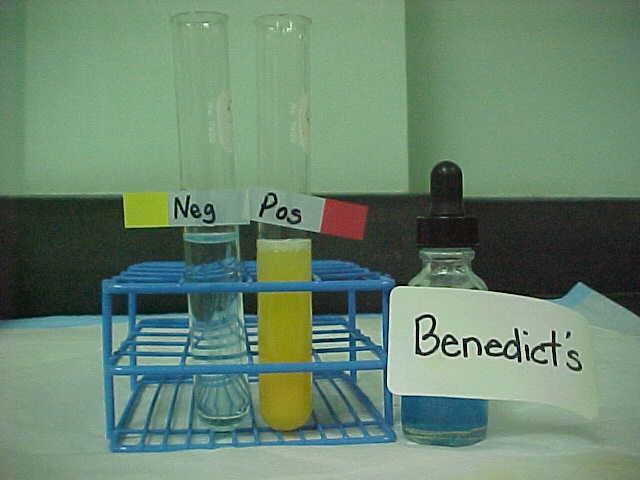 Test for Simple Carbohydrates: Benedict s Benedict's solution is a chemical indicator for