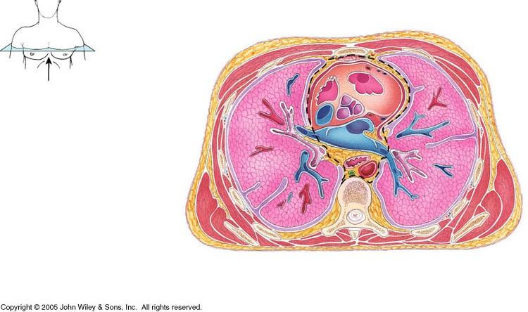 Cross-Sectional Anatomy: Thorax Identify: Pleural cavity Pericardial cavity Heart