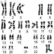 Is this individual Male or Female? 23 Sex Chromosomes.