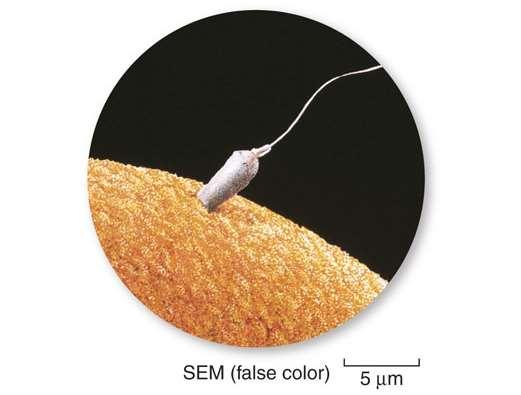 Meiosis Is Essential in Sexual Reproduction Gametes, like the sperm and egg cells in this image, are haploid sex cells.