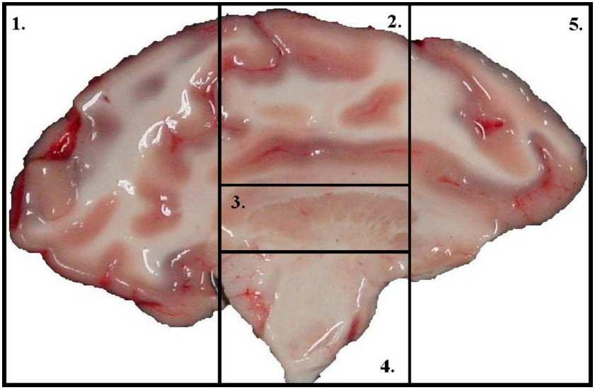 CHAPTER 1. INTRODUCTION 3 Figure 1.1: Brain regions: 1. posterior, 2. superior, 3. thalamus, 4. midbrain, 5.