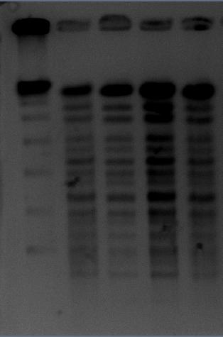 reference. (B) Pulsed-field gel electrophoresis (PFGE) was performed on outbreak isolates to determine whether more resolution could be gained than with rep-pcr.