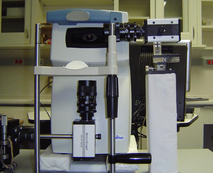 forehead, each of the cameras was mounted on a three-axis translation table. This setup can be seen in figure 3.1. Figure 3.1: ORA and camera setup design for the first human subjects.