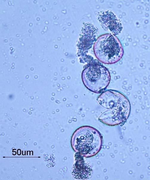 plasmolysis when placed on germination
