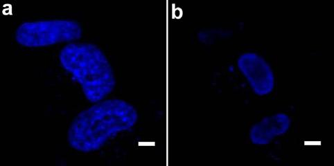 Supplementary Figure 8 Amplified nucleus fluorescence images stained by Hoechst 33342 in the