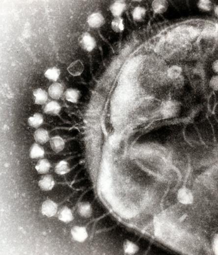 immune system Bacteriophages Antibiotics Shifting