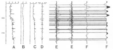 A. Sonic log. B. Density log. C. Acoustic impedance log. D. Log of seismic reflectivity.