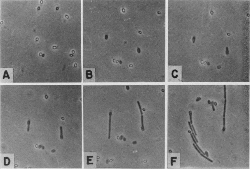 VOL. 16, 1968 EFFECT OF CURING AGENTS ON ANAEROBIC SPORES 407 FIG. 1. Stages in germination and outgrowth of PA 3679h spores in Liver Veal Agar microculture (ph 7.0) at room temperature.