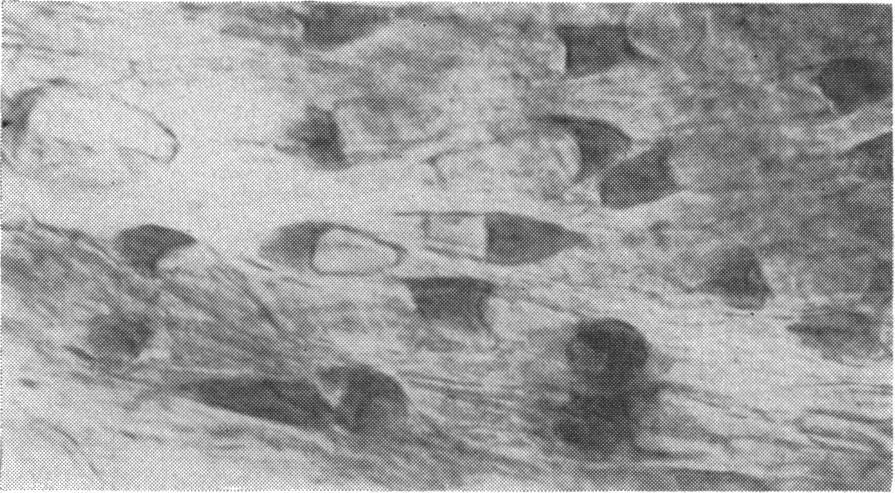 140 JOHN SPEAKMAN endothelial cells lining the trabecular wall of the canal, which vary in diameter from 2,u to 5S and often appear at each end of the fusiform nuclei (Fig. 1).