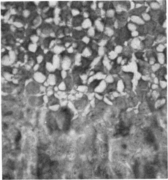 Rinehart Abul-Haj stain. x 950..00 141 Br J Ophthalmol: first published as 10.1136/bjo.43.3.139 on 1 March 1959.