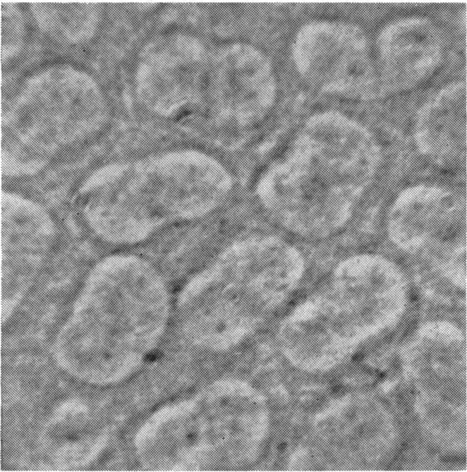 Some of the pale areas within the cells are due to nuclei and others to vacuoles which did not open to the surface.