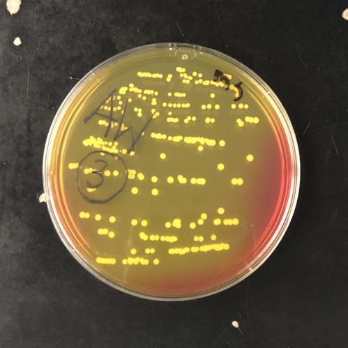 Nutrient Agar to observe how the bacteria grow and the color of their colonies.
