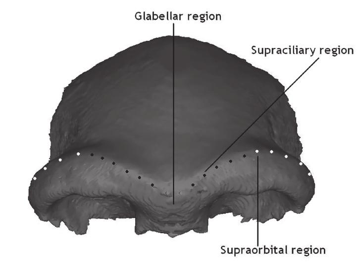 S. Athreya 3 bone. This foramen transmits veins connecting the superior sagittal sinus to the nasal region.