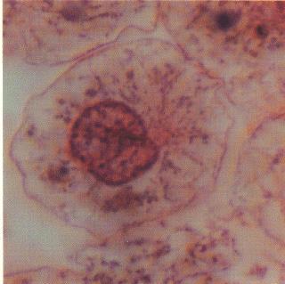 INTERPHASE b. MITOSIS 1. Prophase i. DNA shortens into visible chromatids. ii.