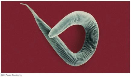 Parasitic Nematodes v Eggs may be infective stage Pinworms (Enterobius vermicularis) v
