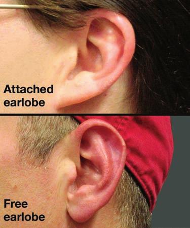 11.1 Traits Tyler has free earlobes like his father. His mother has attached earlobes. Why does Tyler have earlobes like his father?