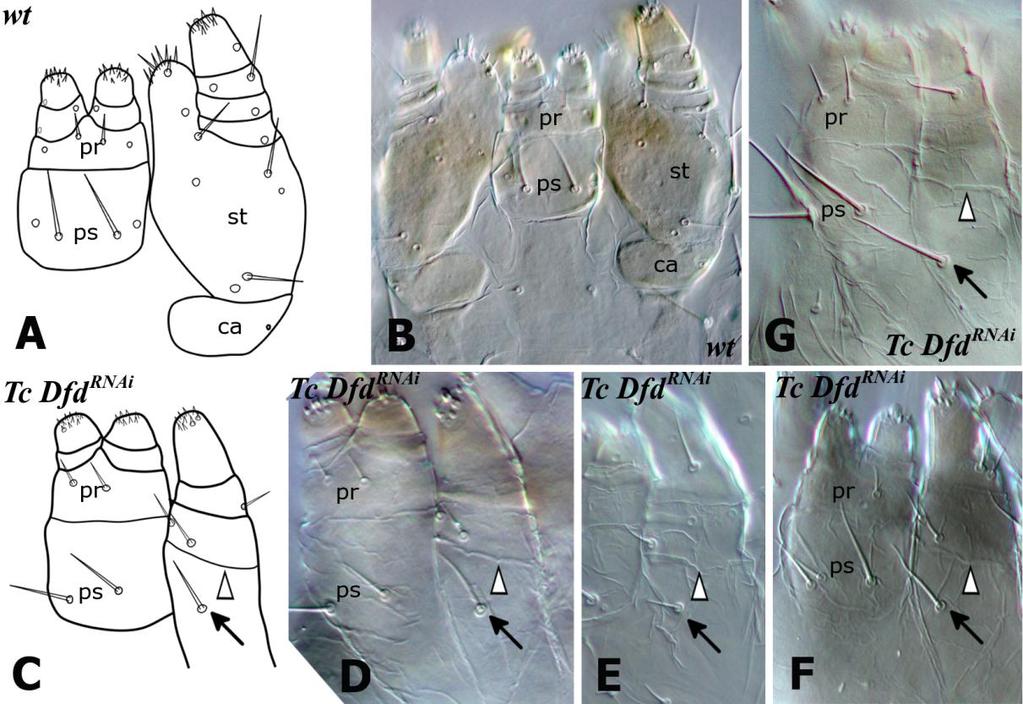 Fig.5.2. Loss of Tc Dfd function affects segmentation and bristle morphology in the larva maxilla. All views of appendages are distal to the top, larval head orientation is anterior to the top.