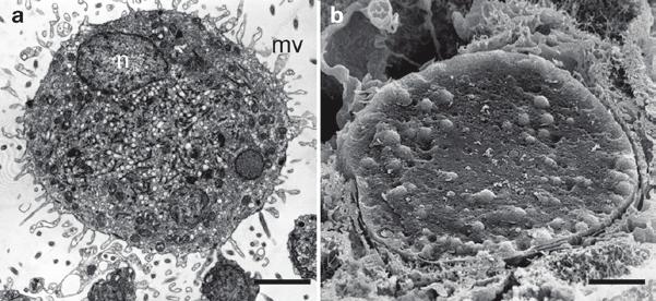 2.2 Embryonic Development 41 Fig. 2.4 Oogenesis in Oopsacas minuta. (a) TEM of the early oocyte during the beginning of vitellogenesis. (b) SEM of an egg in the sponge tissue (Courtesy of J.