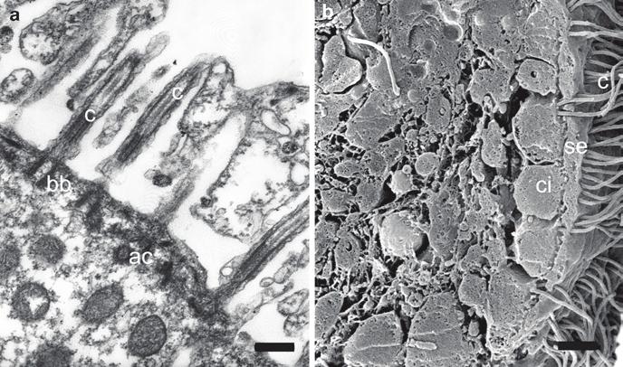 2.4 Metamorphosis 45 Fig. 2.9 Multiciliated cells of Oopsacas minuta trichimellae in the middle part of the larva. (a) TEM and (b) SEM micrographs.