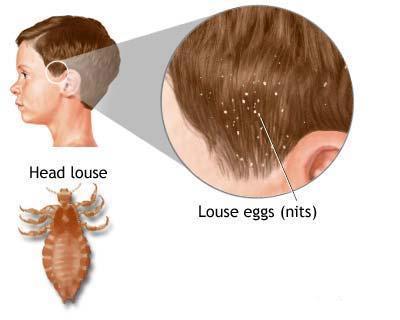 body lice are