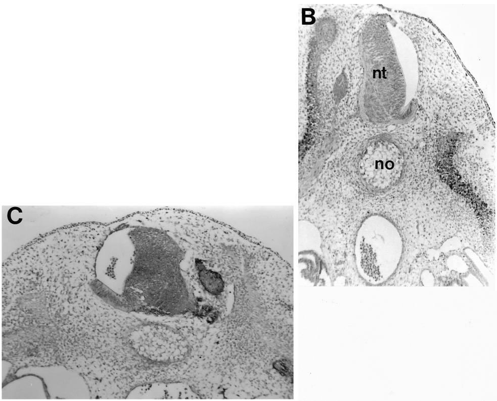 3078 E. Bober and others Fig. 5. Myotome development after removing one lateral half of the neural tube. The operation procedure is shown in A.