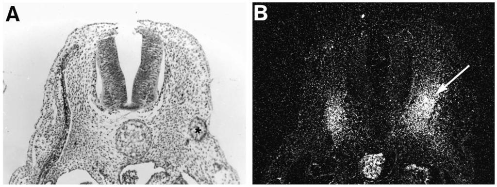 3080 E. Bober and others Fig. 7. Effect of a transplanted notochord on myotome and sclerotome development. The transverse section shown in A was stained with antidesmin antibody.