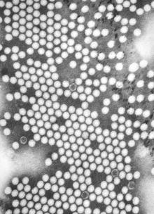 Polio virus under TEM - This virus is 30 nm in size.
