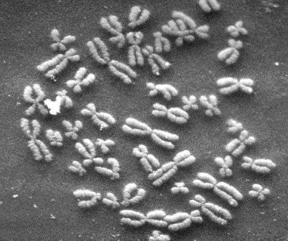 scanning electron micrograph of human chromosomes 2n=46 in humans (shorthand way of describing chromosome content) metaphase chromosome spread Note the size variation and that the centromere is