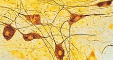 Concentration Cells Nerve cells operate as concentration cells. Inside cell [Na + ] low, [K + ] high; outside cell [Na + ] high, [K + ] low. Outer cell membrane is positive.