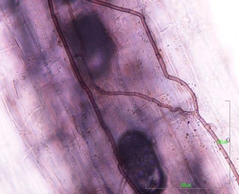 Root density and root length colonized by the fungi were measured by staining the whole root system in 0.