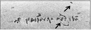 This test revealed that the chromosomes of Tr1 were rarely involved in translocations. Tr1 had common chromosomes only with two lines Tr2 and Tr20 with multiple interchanges [31].