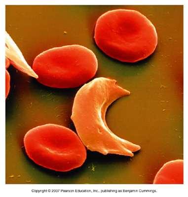 Evidence of natural selection Sickle cell anaemia Affects the formation of haemoglobin Can be fatal in