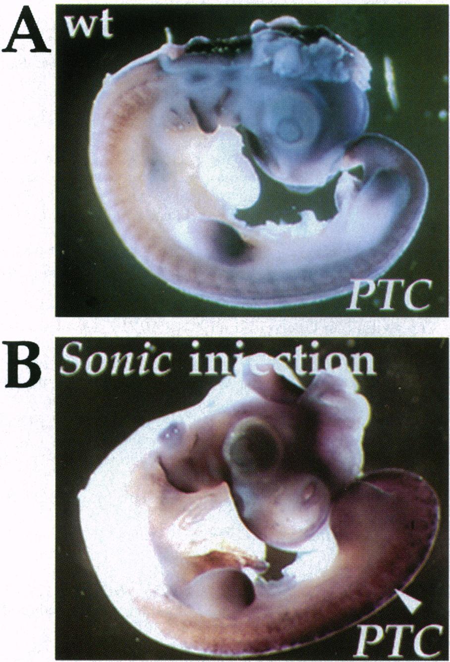 PTC is found in the notochord, ventral part of the somites, and splanchnic mesoderm. The neural tube shows lower levels of PTC expression in the floor plate cells.