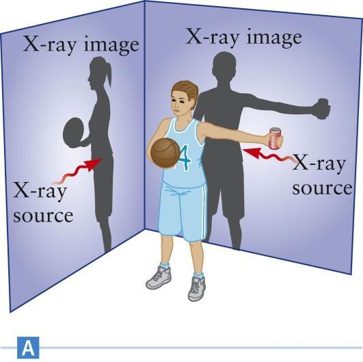 CT Scan With a single X-ray image, there will always be parts f the persn s bdy that are bscured Images can be taken frm different angles A CT scan