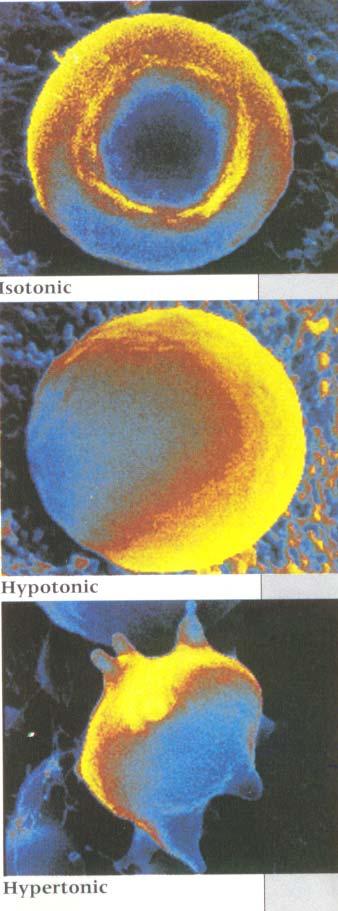 ISOTONIC SOLUTION - identical osmotic pressure to cell fluid HYPOTONIC SOLUTIONS lower osmotic pressure than cell fluid - cell swells & ruptures - transfer of fluid INTO CELL - LYSIS HYPERTONIC