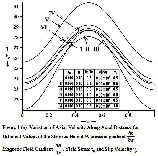 Biomagnetic Steady Flow through an Axisymmetric Stenosed Artery Figure 1(a) gives the variations of the axial velocity versus axial distance for the different values of the stenosis height H,