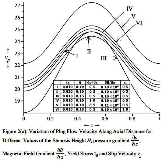 Biomagnetic Steady Flow through an Axisymmetric Stenosed Artery Figure 2(a) describes the changes in plug flow velocity along axial distance for the different values of the stenosis height H,