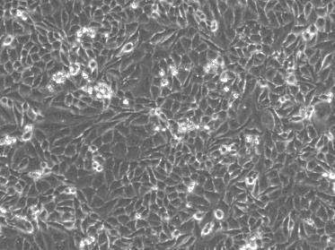 (CHX) (10 μg/ml). (c) Cells were photographed (bar μm).