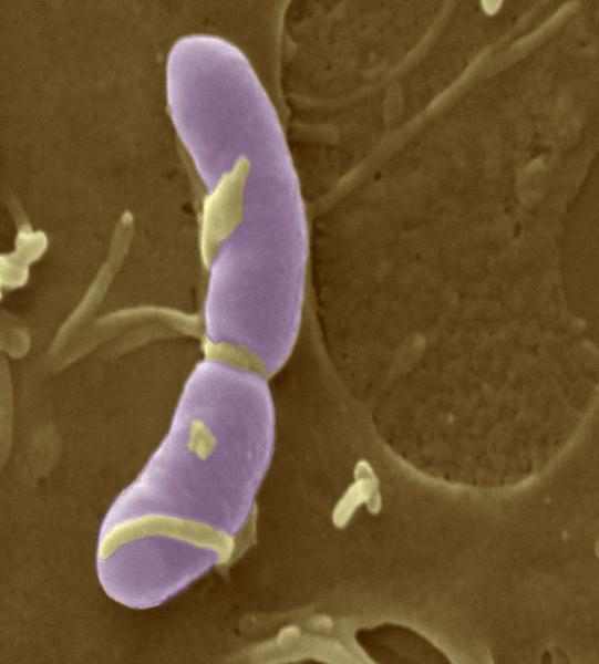 Bacteria in