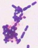 Cell Wall Composition Gram Stain (developed by Hans